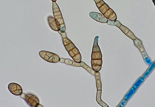 Alternaria (crédit : Xavier Sansico)