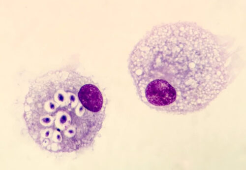 Cryptococcus neoformans (credit : Denis Kharchenko)