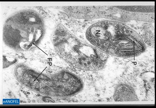 Webinaire le Remic par la SFM : “Microsporidioses intestinales” en replay